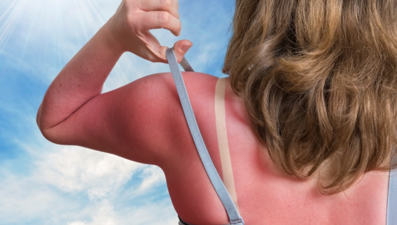 can you tan in uv 3 with clouds